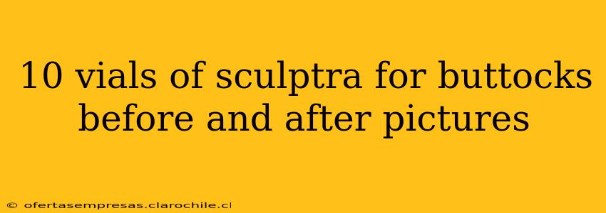 10 vials of sculptra for buttocks before and after pictures
