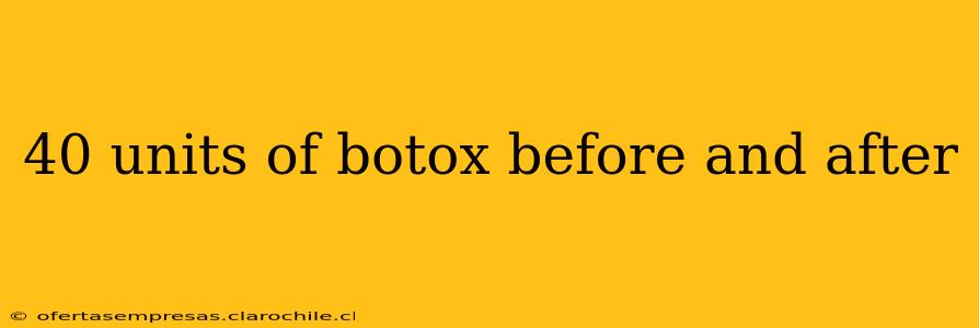 40 units of botox before and after