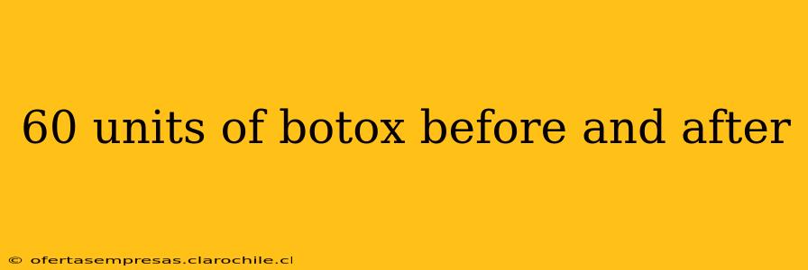 60 units of botox before and after
