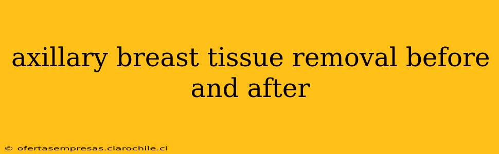 axillary breast tissue removal before and after