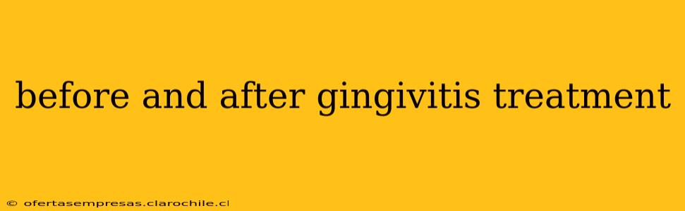 before and after gingivitis treatment
