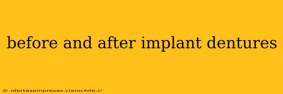 before and after implant dentures