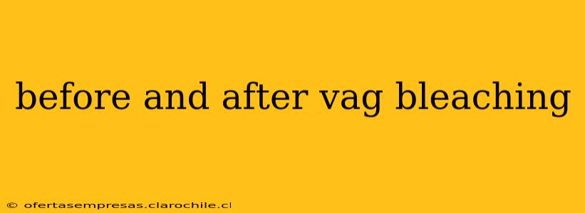 before and after vag bleaching
