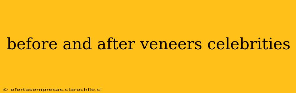 before and after veneers celebrities