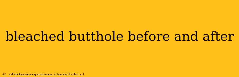 bleached butthole before and after