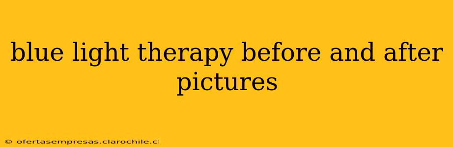 blue light therapy before and after pictures