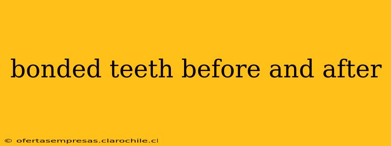 bonded teeth before and after