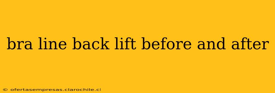 bra line back lift before and after