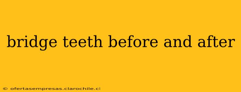 bridge teeth before and after