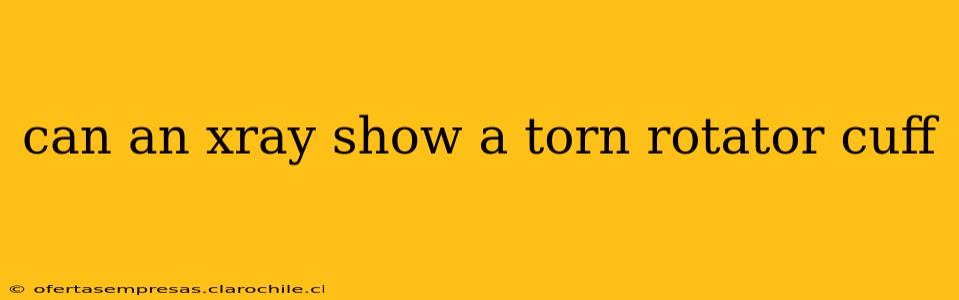 can an xray show a torn rotator cuff