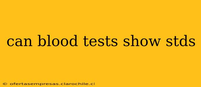 can blood tests show stds