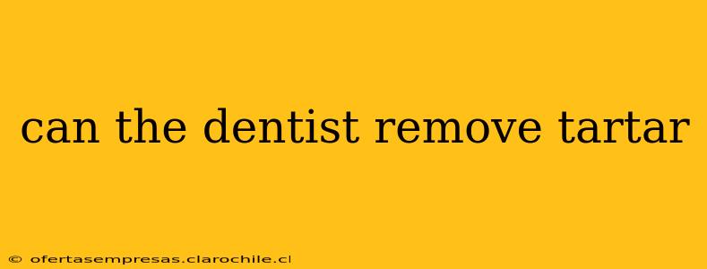 can the dentist remove tartar