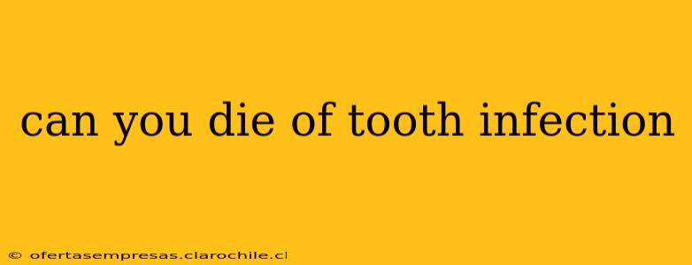 can you die of tooth infection