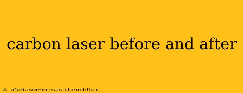 carbon laser before and after