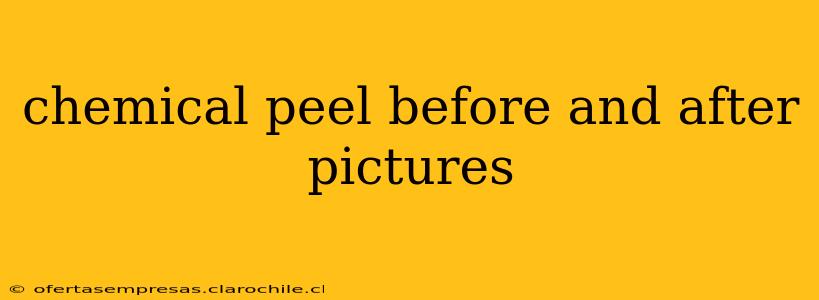 chemical peel before and after pictures