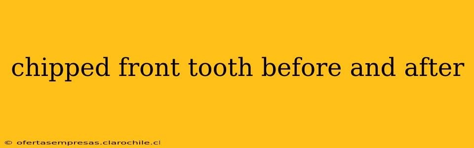 chipped front tooth before and after
