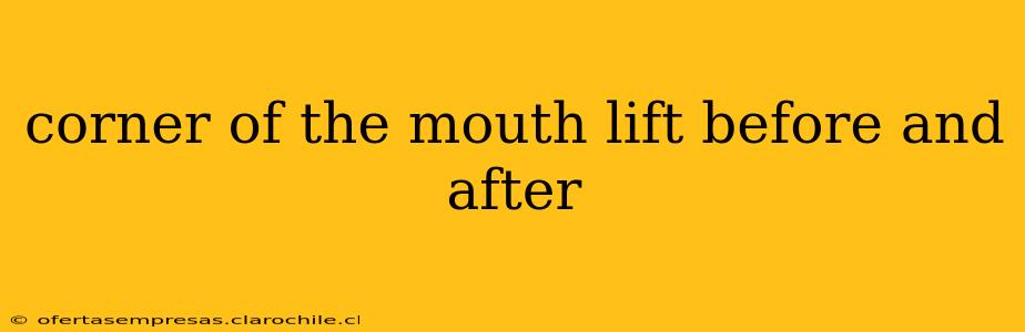 corner of the mouth lift before and after