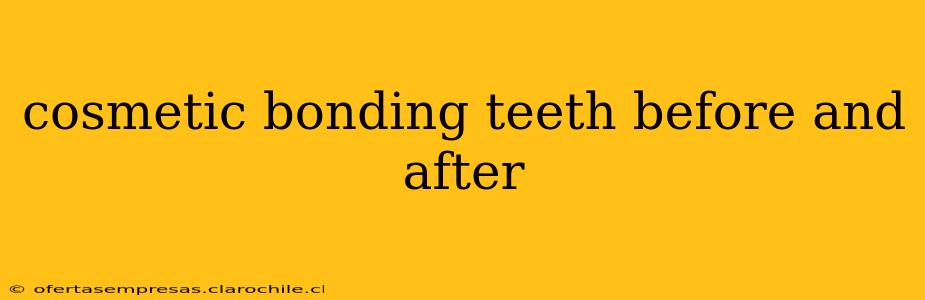 cosmetic bonding teeth before and after