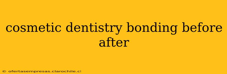 cosmetic dentistry bonding before after