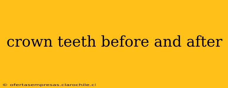 crown teeth before and after