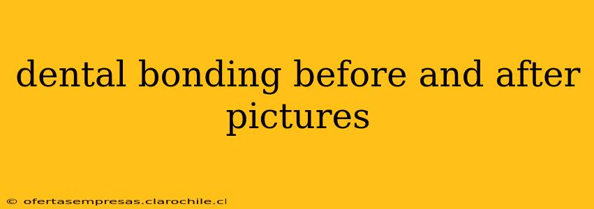 dental bonding before and after pictures