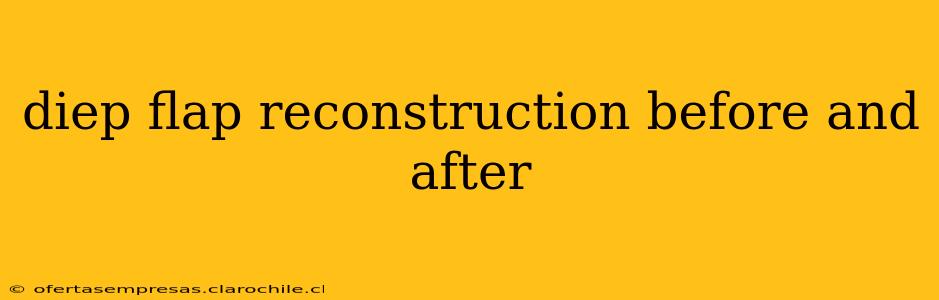 diep flap reconstruction before and after