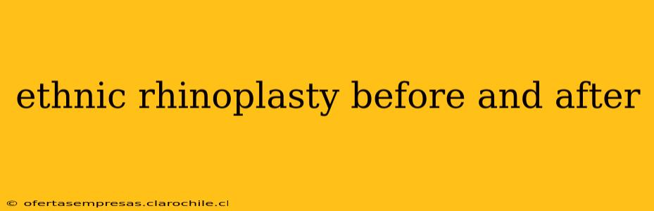 ethnic rhinoplasty before and after