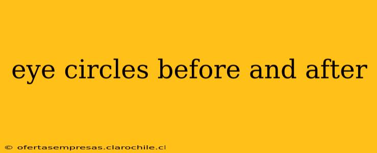 eye circles before and after