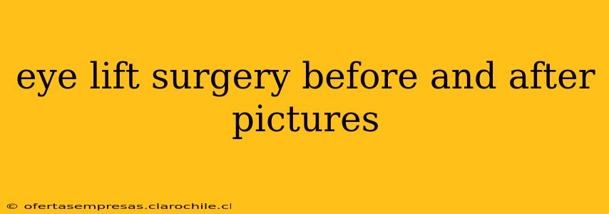 eye lift surgery before and after pictures
