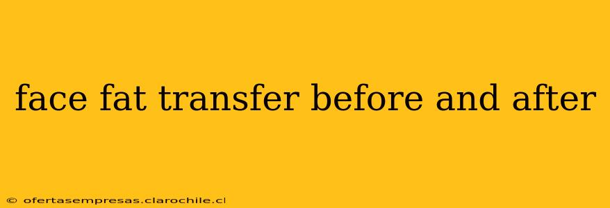 face fat transfer before and after