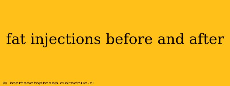 fat injections before and after