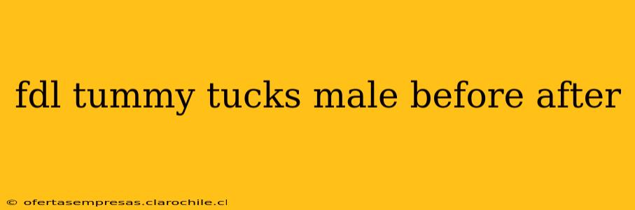 fdl tummy tucks male before after