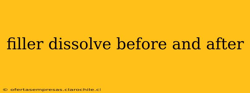 filler dissolve before and after