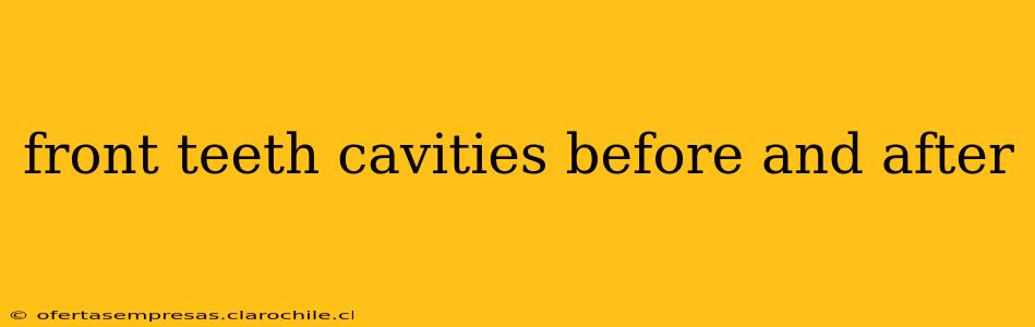front teeth cavities before and after