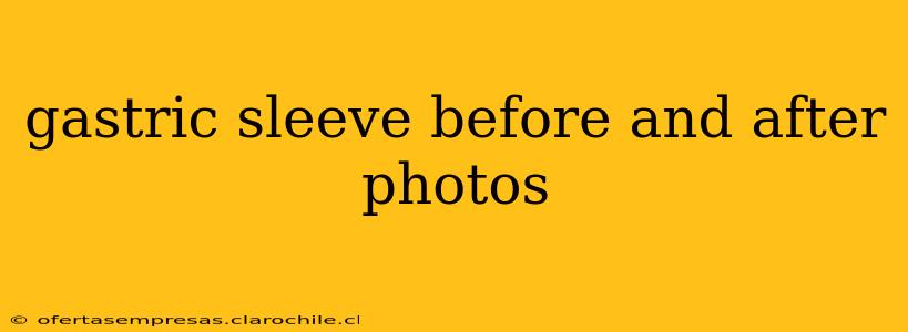 gastric sleeve before and after photos