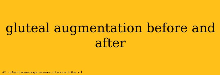 gluteal augmentation before and after