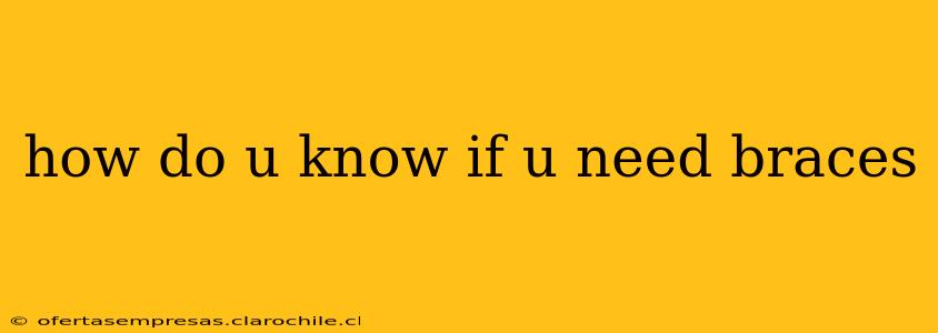 how do u know if u need braces