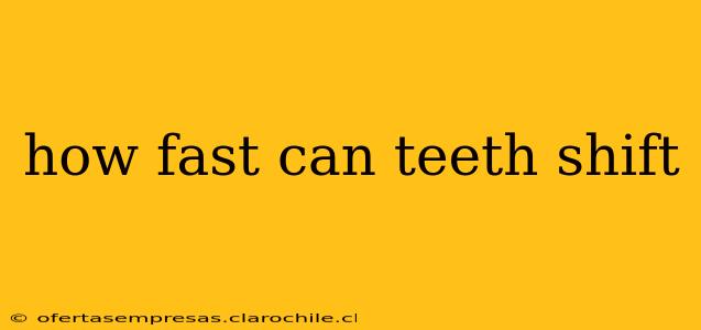 how fast can teeth shift