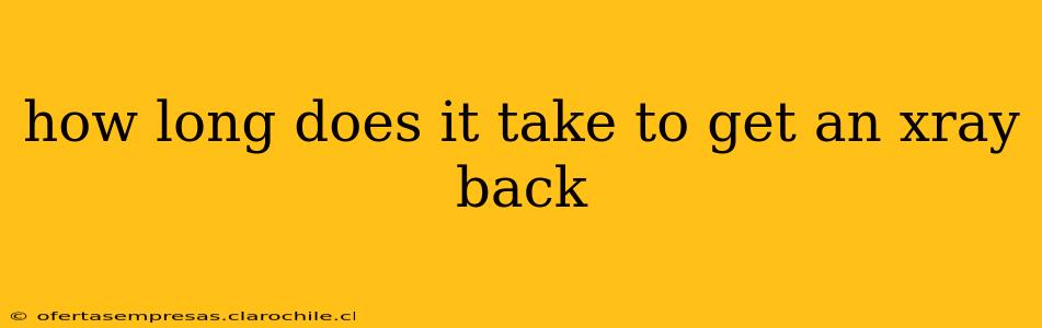 how long does it take to get an xray back