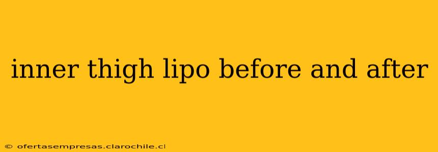inner thigh lipo before and after