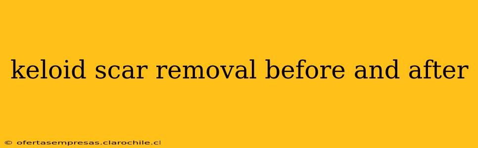 keloid scar removal before and after