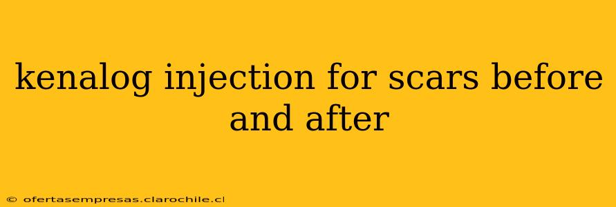 kenalog injection for scars before and after