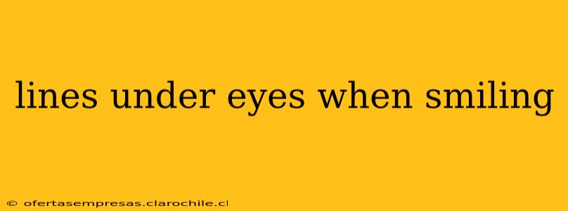 lines under eyes when smiling