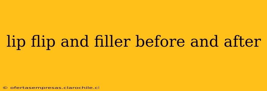 lip flip and filler before and after