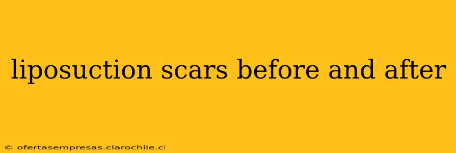 liposuction scars before and after