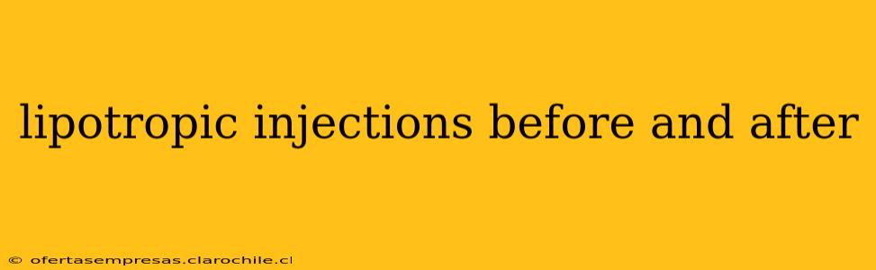 lipotropic injections before and after