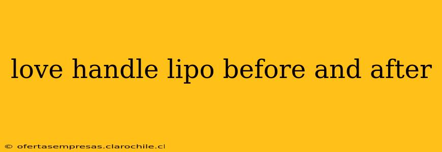love handle lipo before and after