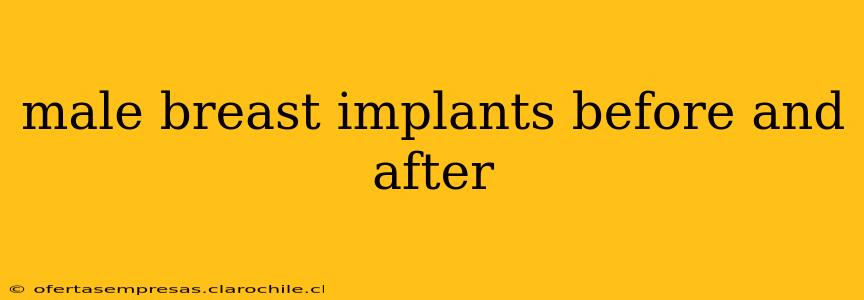 male breast implants before and after