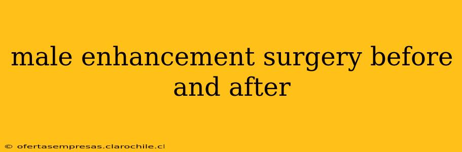 male enhancement surgery before and after
