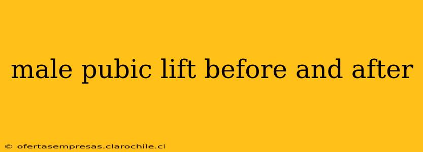 male pubic lift before and after